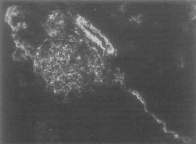 Феномен «волос ангела»: ученые до сих пор бьются над загадкой. Что это может быть?